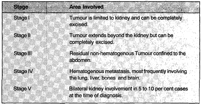 1193_stages of wilm tumour.png